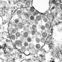 Grayscale microscopic image showing a cluster of round, dark structures within a cell against a grainy background.