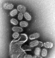 Grayscale electron microscope image of clustered oval-shaped influenza virus particles with a grainy texture.