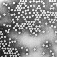Grayscale microscopic image of numerous small, round particles clustered in varying densities across the frame.