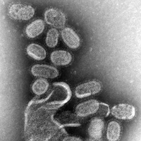 Grayscale electron microscope image of clustered oval-shaped influenza virus particles with a grainy texture.